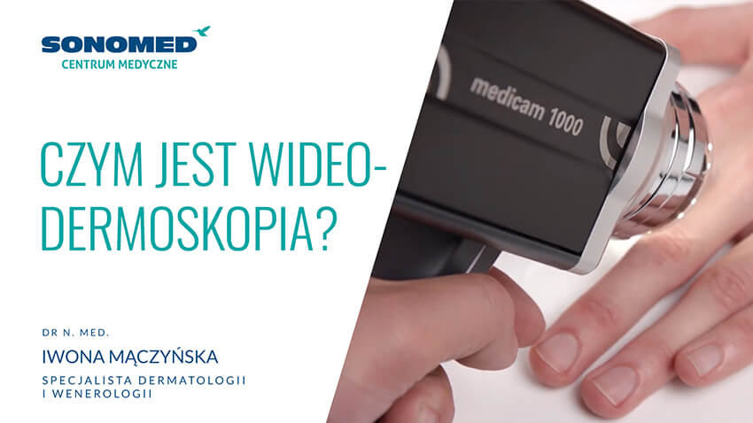 Wideo Sonomed - Czym jest wideodermoskopia?